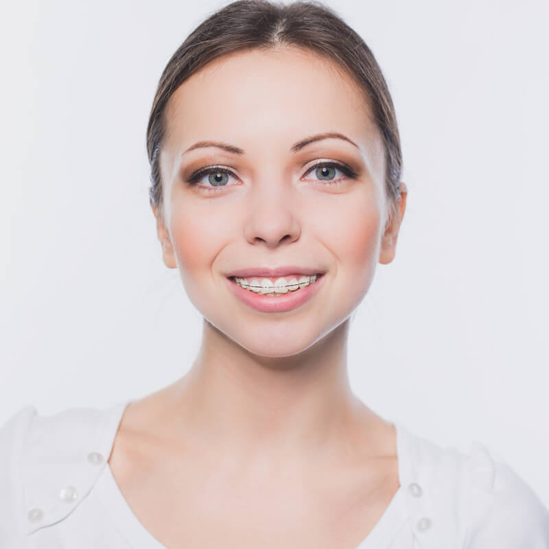 girl with ceramic braces