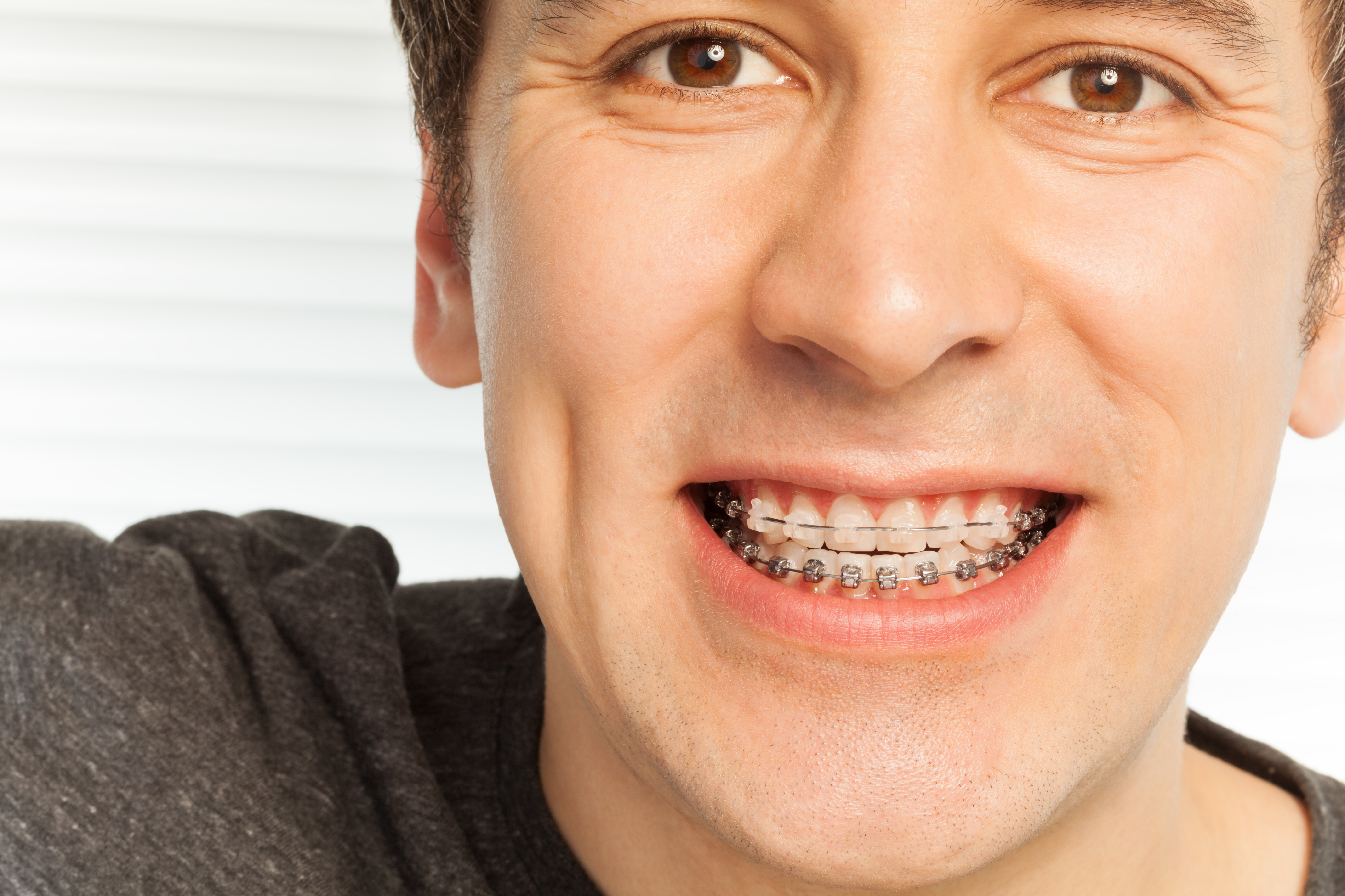 Young man with dental braces on his teeth