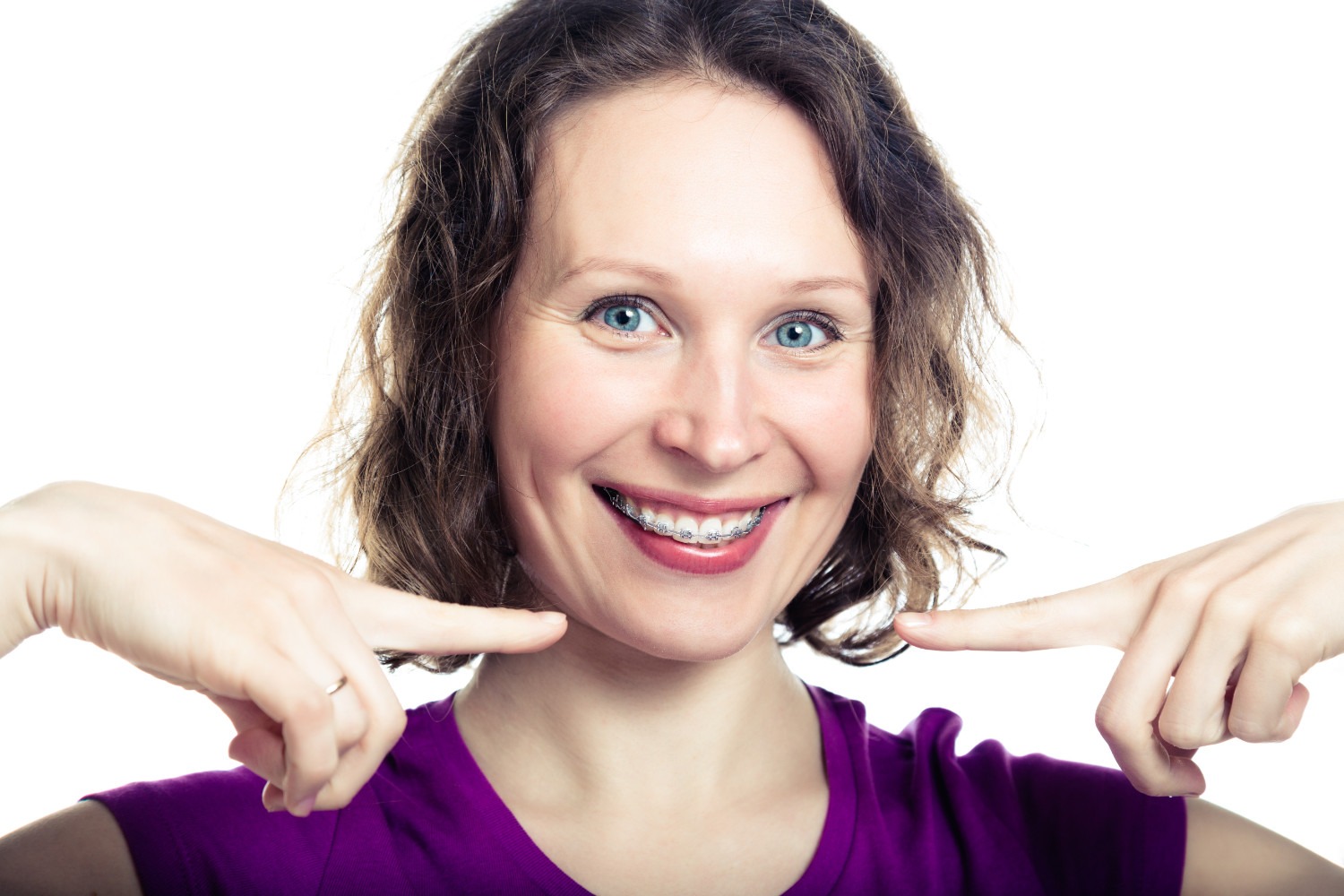 Young lady pointing to her braces