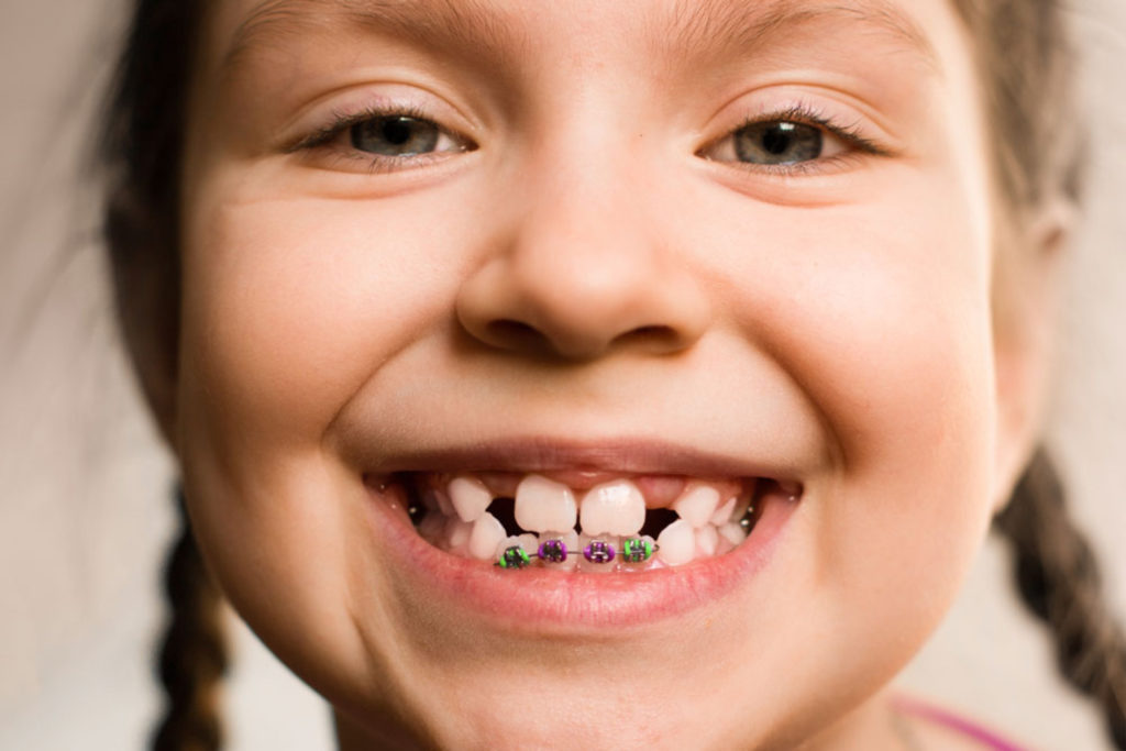 child-bottom-braces 