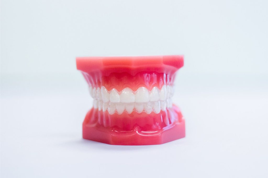 IMG_5832 Myrtle Beach Invisalign