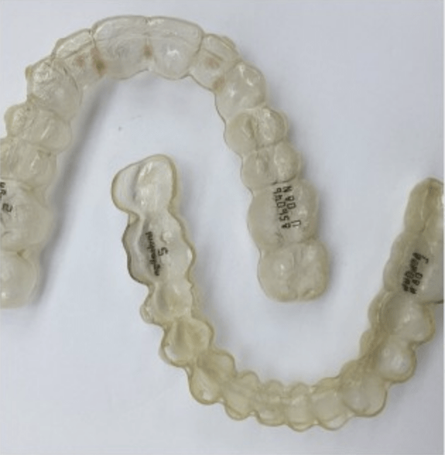 Invisalign Myrtle Beach