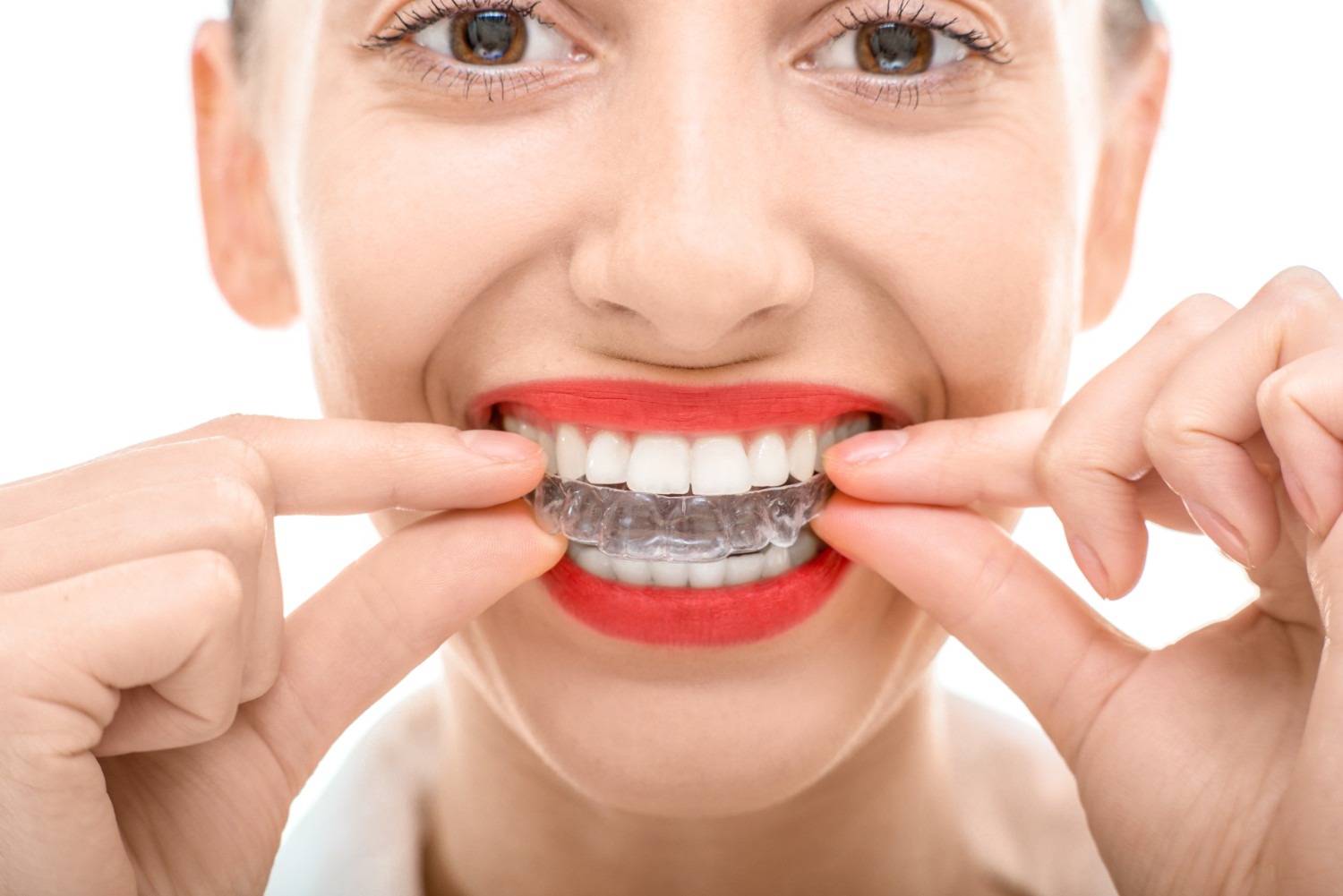 Woman putting in Invisalign aligner Invisalign Myrtle Beach