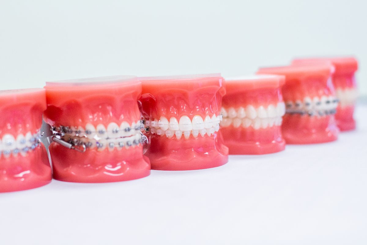 Five Things You Will Not Get with Mail Order Orthodontics