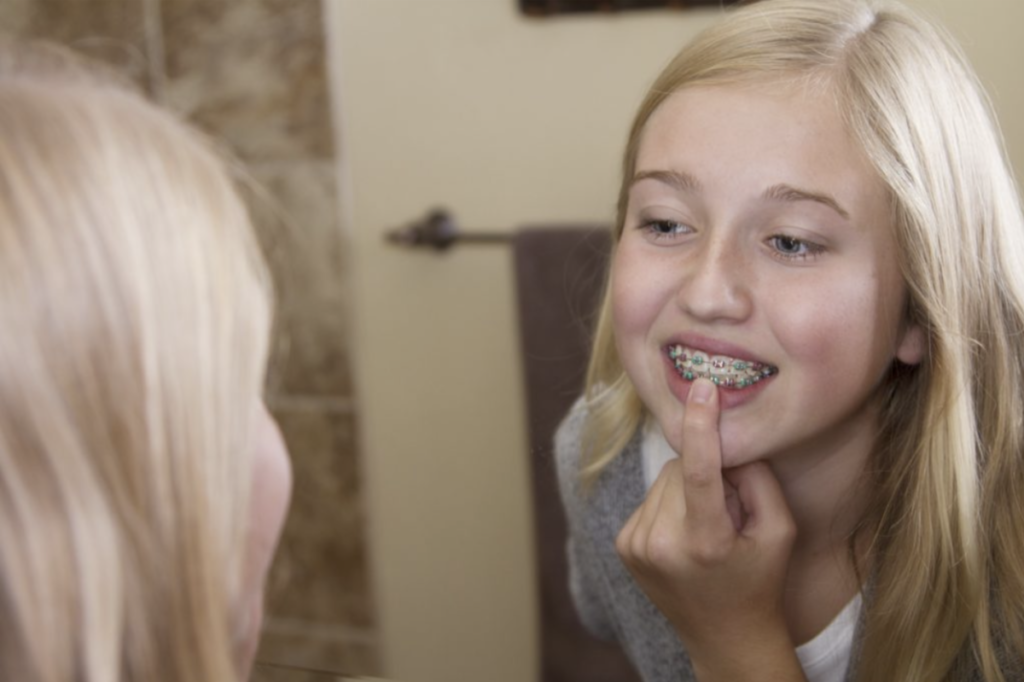 Questions to Ask When Choosing an Orthodontist